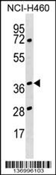 HNRNPH3 Antibody (Center)