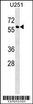 MPI Antibody (N-term)