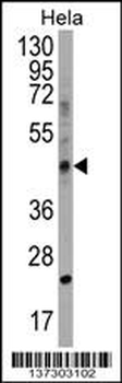 CHID1 Antibody (C-term)