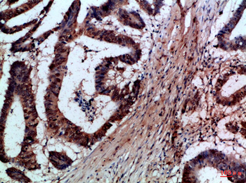 FAS-L Polyclonal Antibody