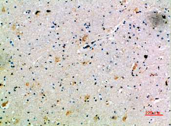 CCL14 Polyclonal Antibody