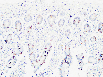 Ret Polyclonal Antibody