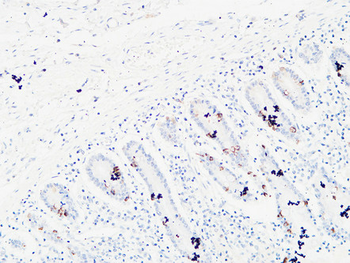 Ret Polyclonal Antibody