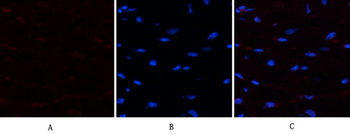 PTEN Polyclonal Antibody