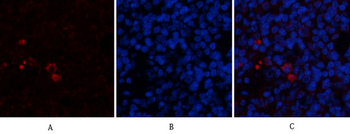 PTEN Polyclonal Antibody