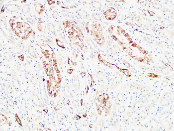 S-100 α Polyclonal Antibody