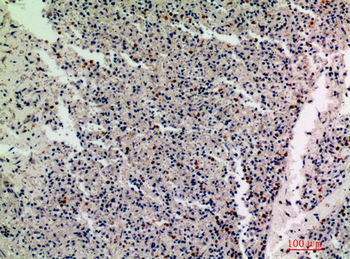 IL-1F10 Polyclonal Antibody