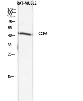 CKR-6 Polyclonal Antibody