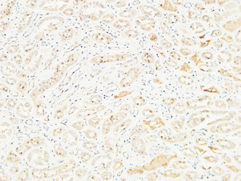 CD26 Polyclonal Antibody