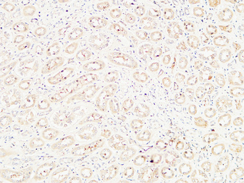 CD26 Polyclonal Antibody