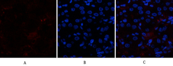 p300 Polyclonal Antibody