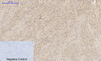 p300 Polyclonal Antibody