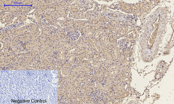 p300 Polyclonal Antibody