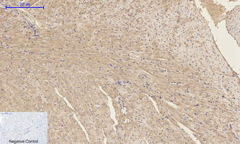 p300 Polyclonal Antibody