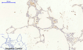 NGF Polyclonal Antibody