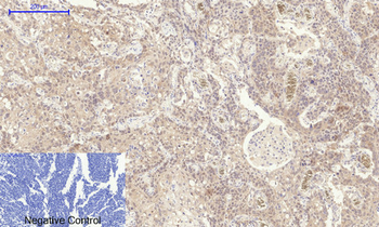 NGF Polyclonal Antibody