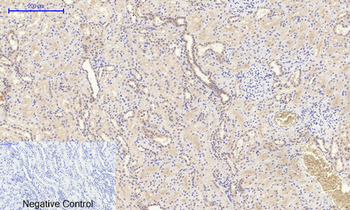 NGF Polyclonal Antibody
