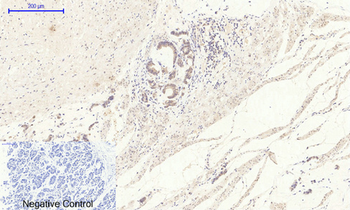 NGF Polyclonal Antibody