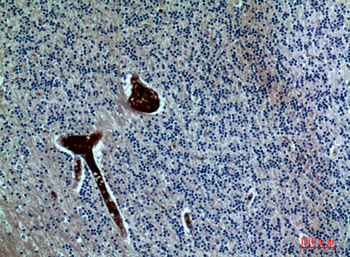 FGF-17 Polyclonal Antibody
