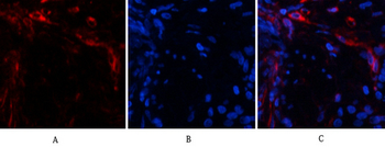 Ub Polyclonal Antibody