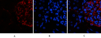 Ub Polyclonal Antibody
