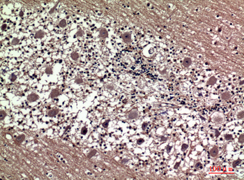 Prolactin Polyclonal Antibody