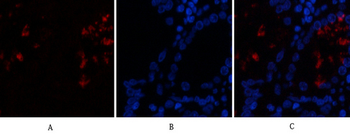 HMG-1 Polyclonal Antibody