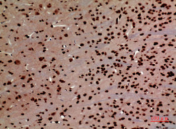 HMG-1 Polyclonal Antibody