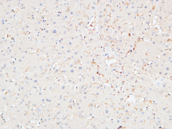 CRF-RI Polyclonal Antibody