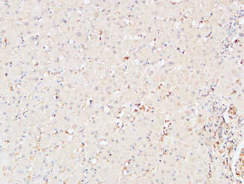 CRF-RI Polyclonal Antibody