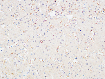 CRF-RI Polyclonal Antibody
