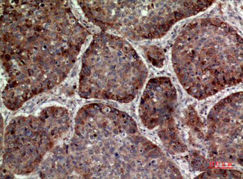 MDA-7 Polyclonal Antibody
