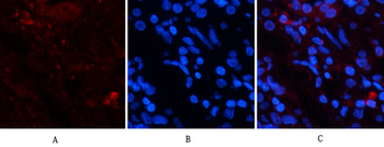 Jagged1 Polyclonal Antibody