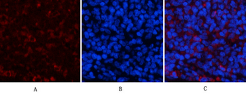 Jagged1 Polyclonal Antibody