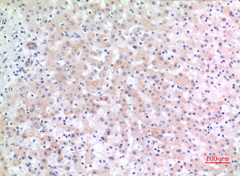 CD166 Polyclonal Antibody
