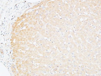 CD166 Polyclonal Antibody