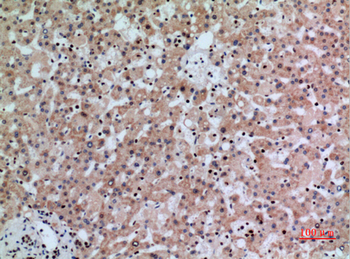 IFN-γRα Polyclonal Antibody