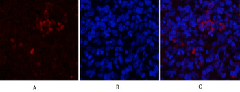 CD81 Polyclonal Antibody