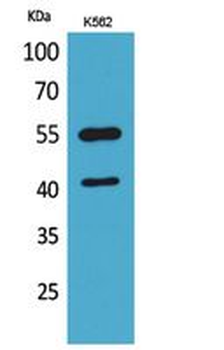 IL-2Rγ Polyclonal Antibody