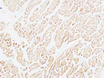 Troponin T-C Polyclonal Antibody