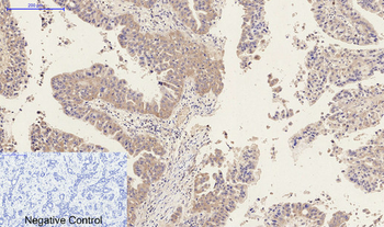 MMP-9 Polyclonal Antibody