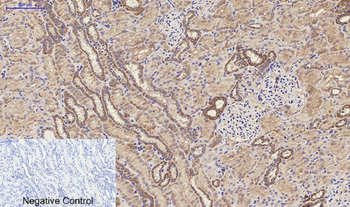 MMP-9 Polyclonal Antibody