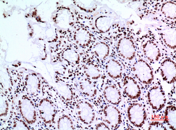 p73 Polyclonal Antibody