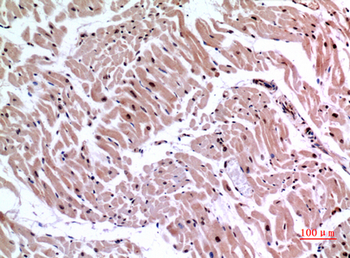 Ku-70 Polyclonal Antibody