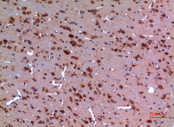 HSP 90 Polyclonal Antibody