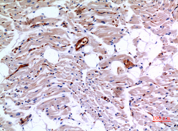IDH3A Polyclonal Antibody