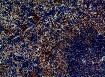 Pax-5 Polyclonal Antibody