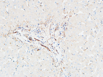 CDCP1 Polyclonal Antibody