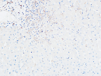 CDCP1 Polyclonal Antibody