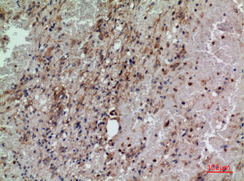 CD160 Polyclonal Antibody